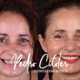 Cada vez más pacientes viajan dentro de España para realizar tratamientos de estética dental en centros especializados.